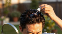 Comb-Over No More: Why Men's Hair Transplants Are Flourishing